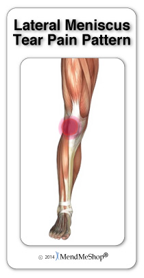 Lateral meniscus pain is felt on the inner side of the knee