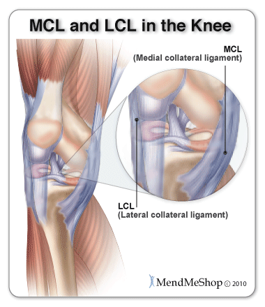 medial knee pain from MCL tear