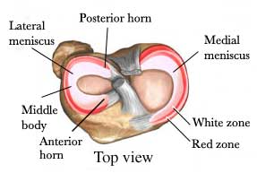 meniscus zones top down view